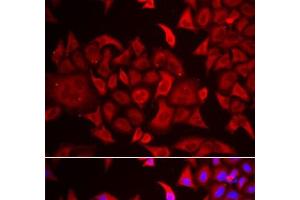 Immunofluorescence analysis of HeLa cells using TARS Polyclonal Antibody (TARS 抗体)
