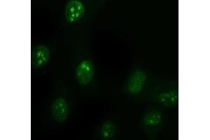 IF analysis of DDX1 using anti-DDX1 antibody (ABIN7602052). (DDX1 抗体  (AA 562-740))