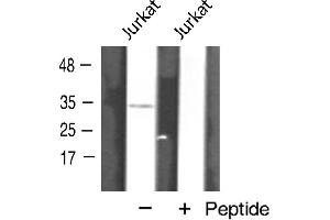 Western blot analysis of AQP12 expression in Jurkat cells (Aquaporin 12A 抗体  (C-Term))