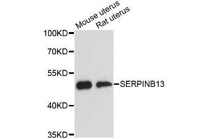 Western blot analysis of extracts of various cell lines, using SERPINB13 antibody (ABIN6292723) at 1:3000 dilution. (SERPINB13 抗体)