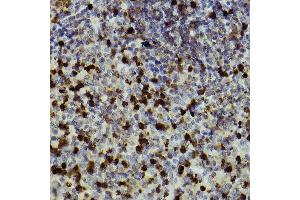 Immunohistochemistry of paraffin-embedded mouse spleen using CD11b/ITGAM antibody (ABIN3022179, ABIN3022180, ABIN3022181 and ABIN6218650) at dilution of 1:100 (40x lens). (CD11b 抗体  (AA 145-340))