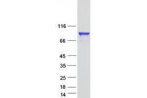 Western Blotting (WB) image for Kinesin Family Member 3B (KIF3B) protein (Myc-DYKDDDDK Tag) (ABIN2724244)