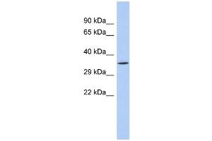 WB Suggested Anti-SIRT4 Antibody Titration:  0. (SIRT4 抗体  (N-Term))