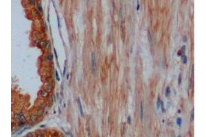 Detection of CK8 in Human Prostate Tissue using Polyclonal Antibody to Cytokeratin 8 (CK8)