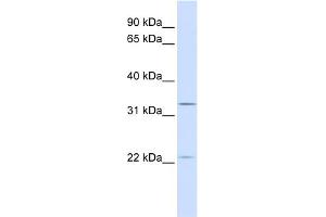 WB Suggested Anti-BRI3BP Antibody Titration:  0. (BRI3BP 抗体  (C-Term))