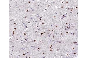 ABIN6266528 at 1/200 staining human brain tissue sections by IHC-P.