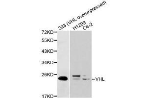 Western blot analysis of extracts of various cell lines, using VHL antibody. (VHL 抗体  (AA 1-172))