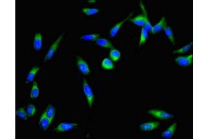 Immunofluorescent analysis of Hela cells using ABIN7149558 at dilution of 1:100 and Alexa Fluor 488-congugated AffiniPure Goat Anti-Rabbit IgG(H+L) (DAPK3 抗体  (AA 283-401))