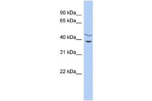 WB Suggested Anti-C11orf77 Antibody Titration: 0. (HARBI1 抗体  (Middle Region))