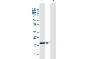 Western Blot analysis of UBE2L6 expression in transfected 293T cell line by UBE2L6 MaxPab polyclonal antibody. (UBE2L6 抗体  (AA 1-153))