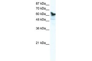 DDX41 antibody used at 1. (DDX41 抗体)