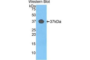 Western blot analysis of the recombinant protein. (FBLN4 抗体  (AA 278-366))