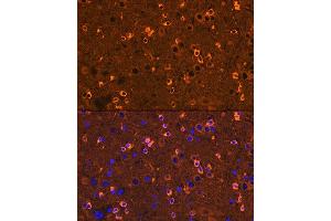 Immunofluorescence analysis of mouse brain using CRMP2/DPYSL2 Rabbit mAb  at dilution of 1:100 (40x lens). (DPYSL2 抗体)