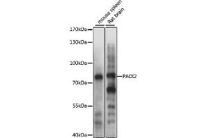 Western blot analysis of extracts of various cell lines, using P antibody (ABIN6128410, ABIN6145163, ABIN6145165 and ABIN6215405) at 1:1000 dilution. (PADI2 抗体  (AA 26-210))