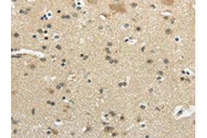 The image on the left is immunohistochemistry of paraffin-embedded Human brain tissue using ABIN7193051(WNK2 Antibody) at dilution 1/35, on the right is treated with synthetic peptide. (WNK2 抗体)