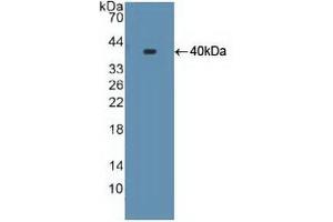 Figure. (CYP17A1 抗体  (AA 183-508))