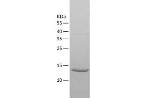 Western Blotting (WB) image for Synuclein, gamma (Breast Cancer-Specific Protein 1) (SNCG) (AA 1-127) protein (His tag) (ABIN7284667) (SNCG Protein (AA 1-127) (His tag))