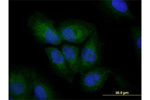 Immunofluorescence of monoclonal antibody to VIM on U-2 OS cell. (Vimentin 抗体  (AA 41-140))