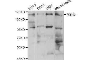 Western blot analysis of extracts of various cell lines, using MSH6 antibody. (MSH6 抗体  (AA 1-290))