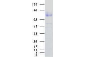 Western Blotting (WB) image for Neurotrophic Tyrosine Kinase, Receptor, Type 2 (NTRK2) (Transcript Variant B) protein (Myc-DYKDDDDK Tag) (ABIN2734331)