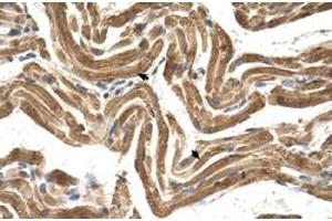 Immunohistochemical staining (Formalin-fixed paraffin-embedded sections) of human muscle with FICD polyclonal antibody  at 4-8 ug/mL working concentration. (FICD 抗体  (C-Term))