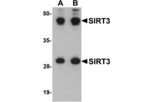 Western blot analysis of SIRT3 in mouse heart tissue lysate with SIRT3 antibody at (A) 1 and (B) 2 μg/ml. (SIRT3 抗体  (Center))