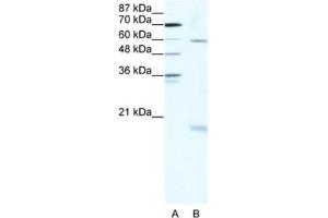 Western Blotting (WB) image for anti-SRY (Sex Determining Region Y)-Box 9 (SOX9) antibody (ABIN2463814) (SOX9 抗体)