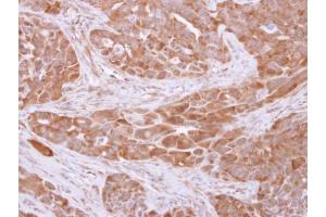 IHC-P Image 14-3-3 theta antibody detects YWHAQ protein at cytosol on H358 xenograft by immunohistochemical analysis. (14-3-3 theta 抗体  (Center))