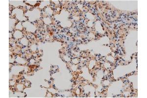 ABIN6267433 at 1/200 staining Mouse lung tissue sections by IHC-P.