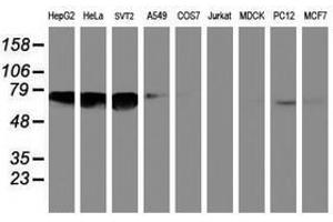 Image no. 1 for anti-N-Myristoyltransferase 2 (NMT2) antibody (ABIN1499784) (NMT2 抗体)