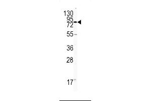 Western Blotting (WB) image for anti-Platelet/endothelial Cell Adhesion Molecule (PECAM1) (AA 690-718), (C-Term) antibody (ABIN5532859)