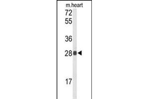 Western blot analysis of TSN1 Antibody (Center) (ABIN652638 and ABIN2842428) in mouse heart tissue lysates (35 μg/lane).