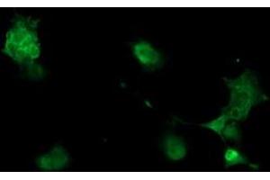 Image no. 3 for anti-phosphorylase Kinase, gamma 2 (Testis) (PHKG2) (AA 1-216) antibody (ABIN1490612)