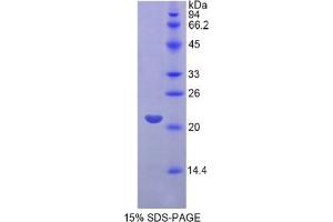 SDS-PAGE of Protein Standard from the Kit (Highly purified E. (FGF13 ELISA 试剂盒)