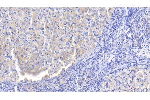 Detection of LBP in Rat Ovary Tissue using Polyclonal Antibody to Lipopolysaccharide Binding Protein (LBP) (LBP 抗体  (AA 226-480))