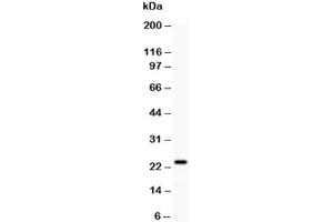 Western blot testing of Claudin-5 antibody and rat liver (Claudin 5 抗体  (AA 191-218))
