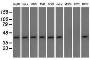 Image no. 3 for anti-Nucleoredoxin-Like 2 (NXNL2) antibody (ABIN1499887) (NXNL2 抗体)