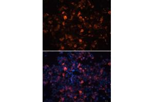 Immunofluorescence analysis of 293T cells using Mouse anti His-Tag mAb.