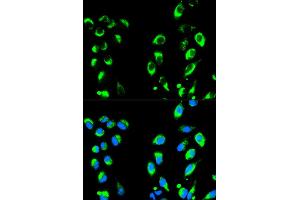 Immunofluorescence analysis of HeLa cells using NFKBIA antibody (ABIN4904527). (NFKBIA 抗体)