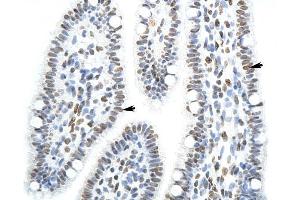 SFPQ antibody was used for immunohistochemistry at a concentration of 4-8 ug/ml to stain Epithelial cells of renal tubule (arrows) in Human Intestine. (SFPQ 抗体)