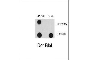 Dot blot analysis of Phospho-EGFR- Antibody (ABIN389764 and ABIN2839686) and EGFR Non Phospho-specific Pab on nitrocellulose membrane. (EGFR 抗体  (pTyr1125))