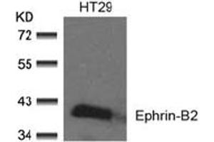Image no. 2 for anti-Ephrin B2 (EFNB2) (AA 328-332) antibody (ABIN197418) (Ephrin B2 抗体  (AA 328-332))