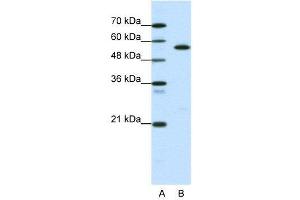 WB Suggested Anti-CORO1A  Antibody Titration: 0. (Coronin 1a 抗体  (Middle Region))