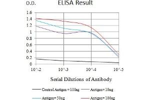 Black line: Control Antigen (100 ng),Purple line: Antigen (10 ng), Blue line: Antigen (50 ng), Red line:Antigen (100 ng) (LRP12 抗体  (AA 355-492))