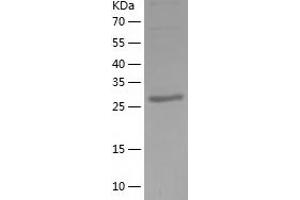 Western Blotting (WB) image for Calbindin 2 (CALB2) (AA 1-271) protein (His tag) (ABIN7122076) (Calretinin Protein (AA 1-271) (His tag))