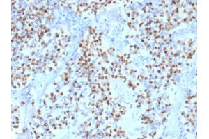 Formalin-fixed, paraffin-embedded human Lymph Node stained with Oct-2 Mouse Monoclonal Antibody (OCT2/2136). (Oct-2 抗体  (AA 112-297))