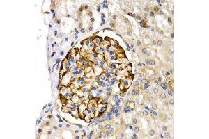 Immunohistochemistry (IHC) image for anti-Lipase, Endothelial (LIPG) (AA 251-500) antibody (ABIN6219026) (LIPG 抗体  (AA 251-500))