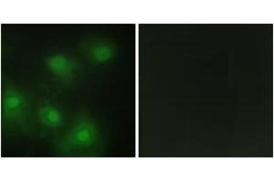 Immunofluorescence analysis of HeLa cells, using CDK2 Antibody. (CDK2 抗体  (AA 231-280))