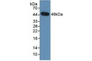 Detection of Recombinant NEU, Human using Monoclonal Antibody to Neuraminidase (NEU) (NEU1 抗体  (AA 47-415))