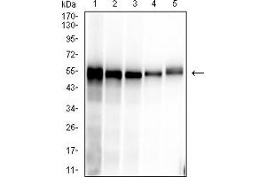 Western blot analysis using SARS-CoV-2-NP1 mAb against human SARS-CoV-2-N (AA: 1-419) recombinant protein. (SARS-Cov2-NP1 (AA 1-180) 抗体)